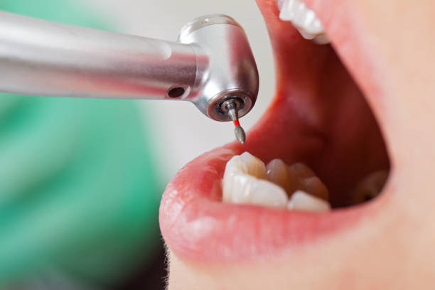 Best Broken or Cracked Tooth Emergency Dentist in Genoa, AR